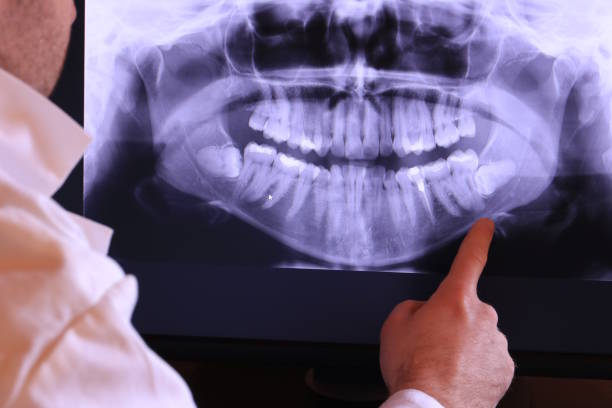Best Broken or Chipped Tooth Repair in Tton, IL